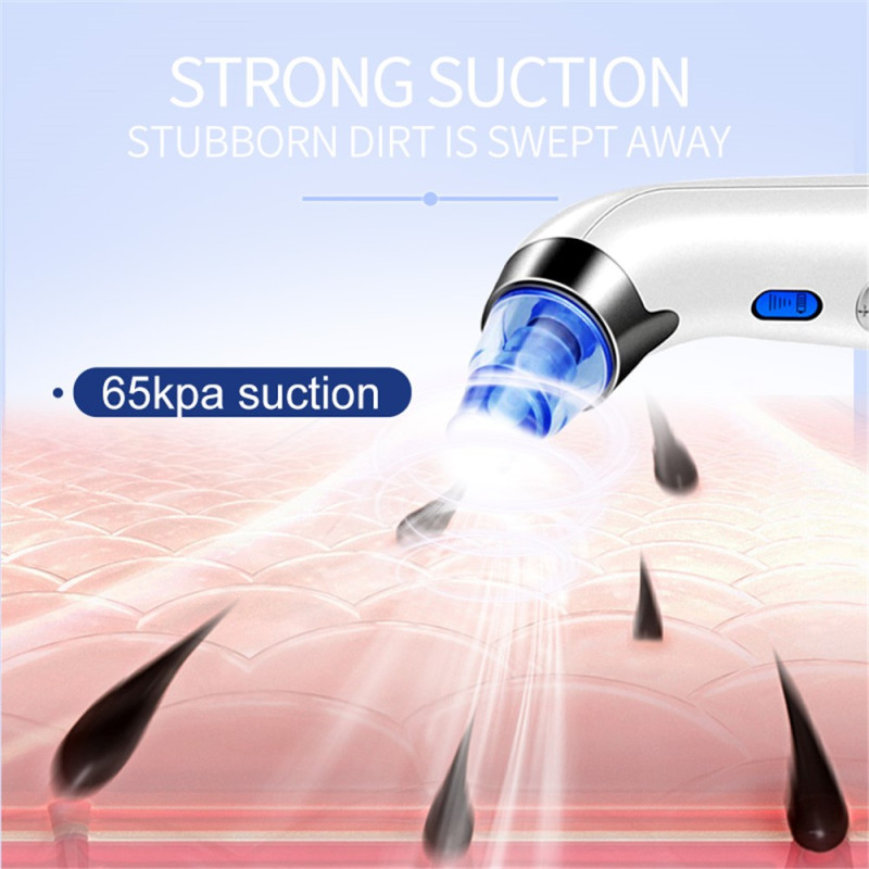 Електричний пристрій для видалення чорних цяток DYM-001 з 5 рівнями всмоктування та 4 насадками (Білий)