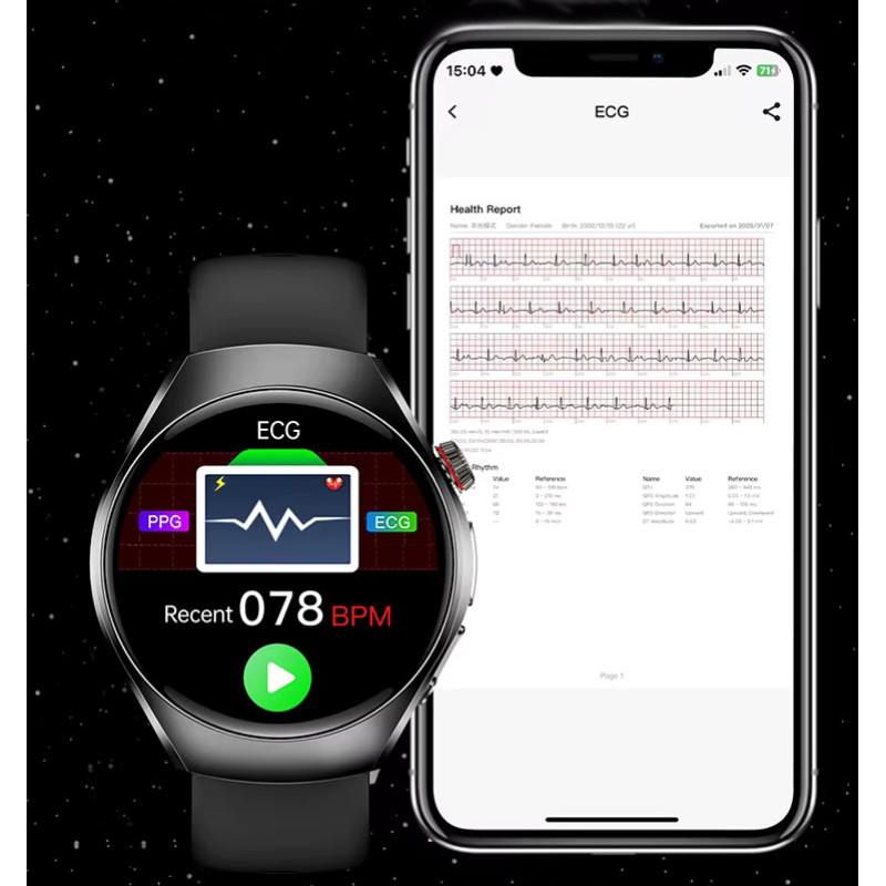 Смарт-годинник Lemfo ET460 з вимірюванням тиску ЕКГ та Bluetooth-дзвінками (Чорний)