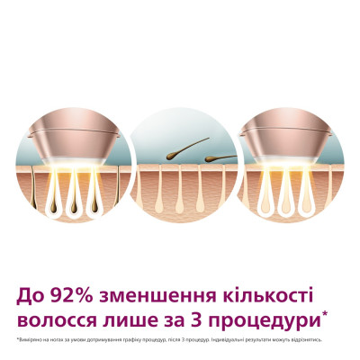 Фотоепілятор Philips Lumea IPL 9900 Series BRI973/00 Білий/Золотий UA Фотоепілятор Philips Lumea IPL 9900 Series BRI973/00 Білий/Золотий UA