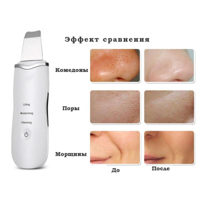 Апарат для ультразвукового чищення обличчя Ultrasonic Shovel