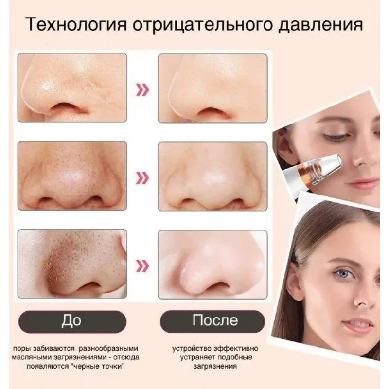 Вакуумний очищувач шкіри та пор Multi-Functional для чищення обличчя