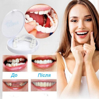 Вініри для зубів верх Snap On Smile