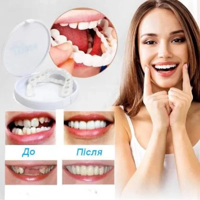 Вініри для зубів верх Snap On Smile