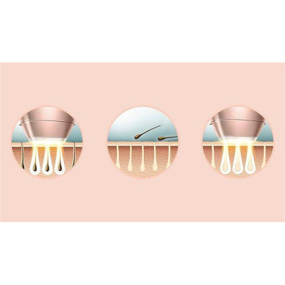 Фотоепілятор Philips Lumea IPL 9900 Series BRI977/00